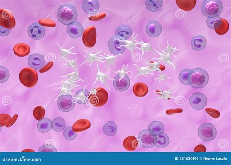 trombocitemie esentiala|Trombocitemia Esentiala (TE) 